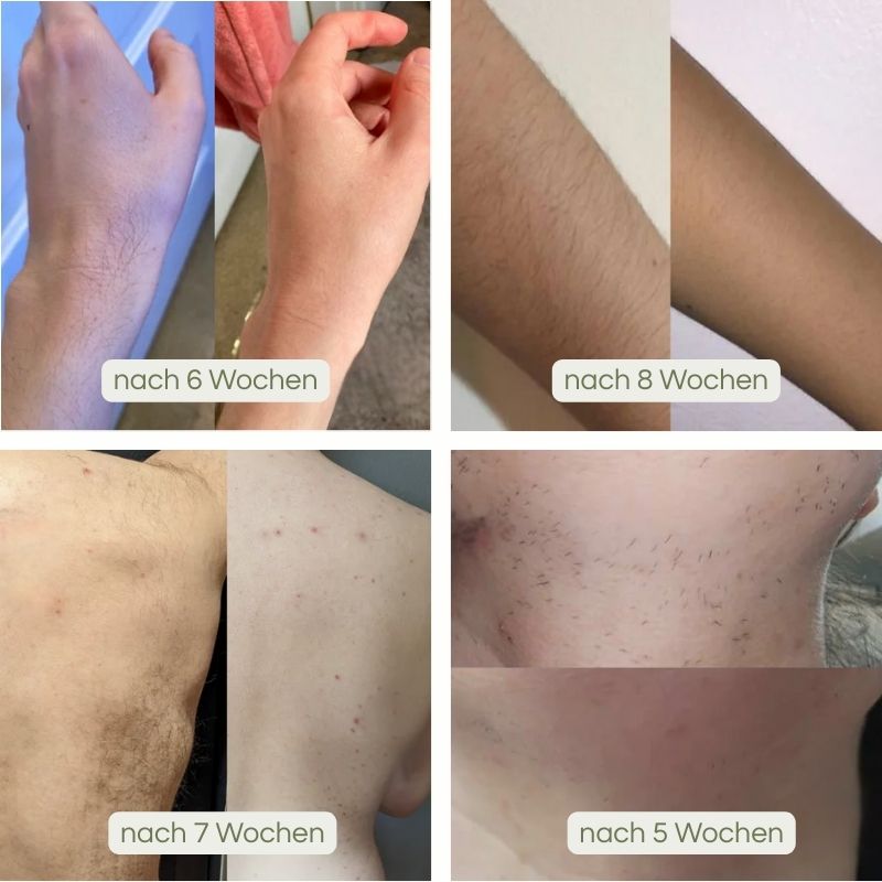 PureBella-IPL Haarentferner