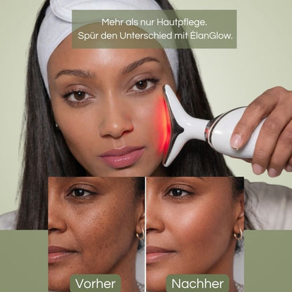 ÈlanGlow – LED Face & Neck Lifter