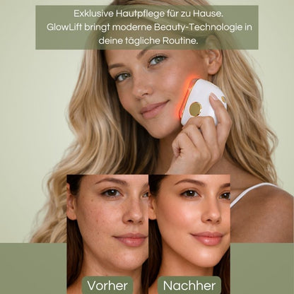 GlowLift – EMS Gesichtslifter