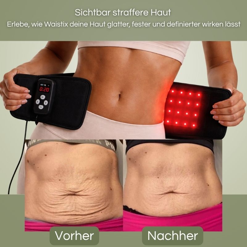 Waistix – Rotlicht- & Infrarot-Gürtel für deine Silhouette