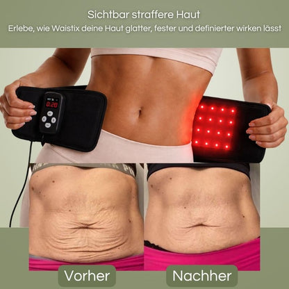 Waistix – Rotlicht- & Infrarot-Gürtel für deine Silhouette