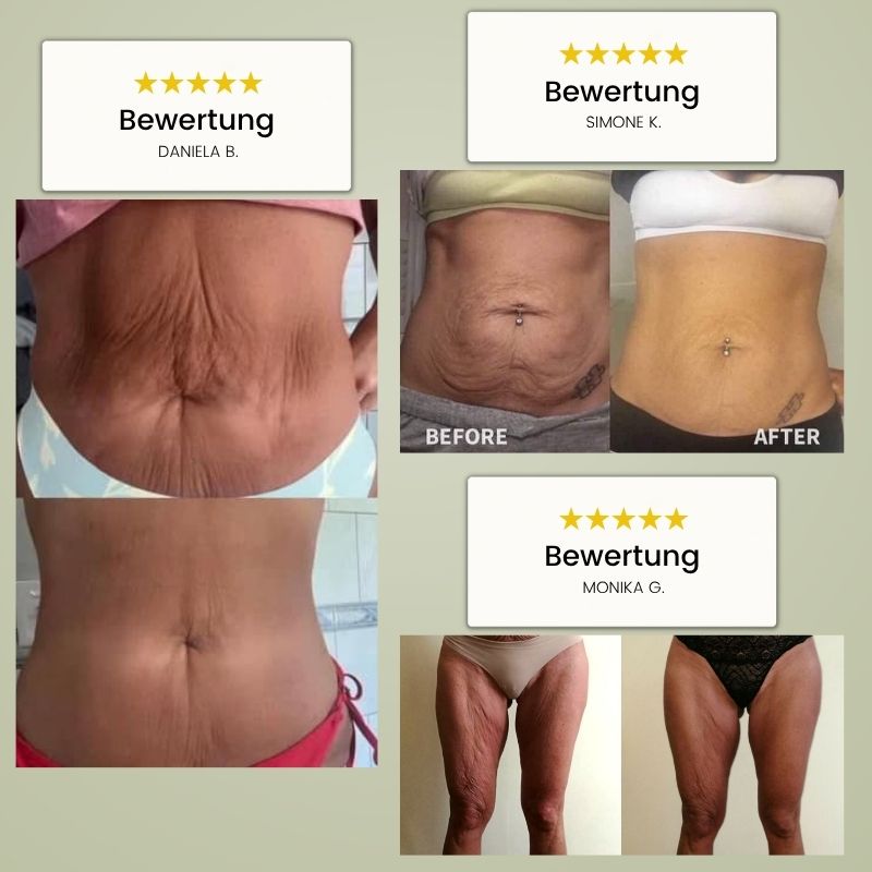 Waistix – Rotlicht- & Infrarot-Gürtel für deine Silhouette